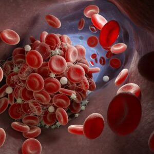 4014 – Anti-Cardiolipin Screen