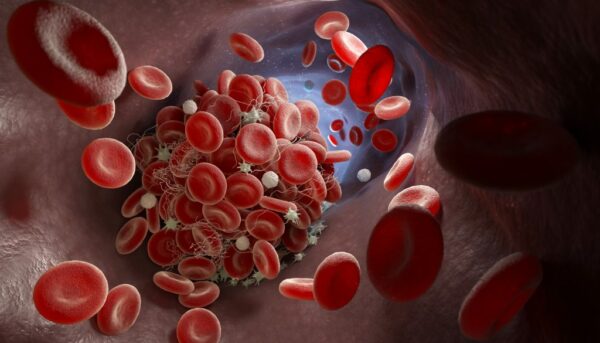4050 – Anti-Phospholipid screen