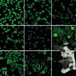 8101, 81040 – ANA HEp-2 plus